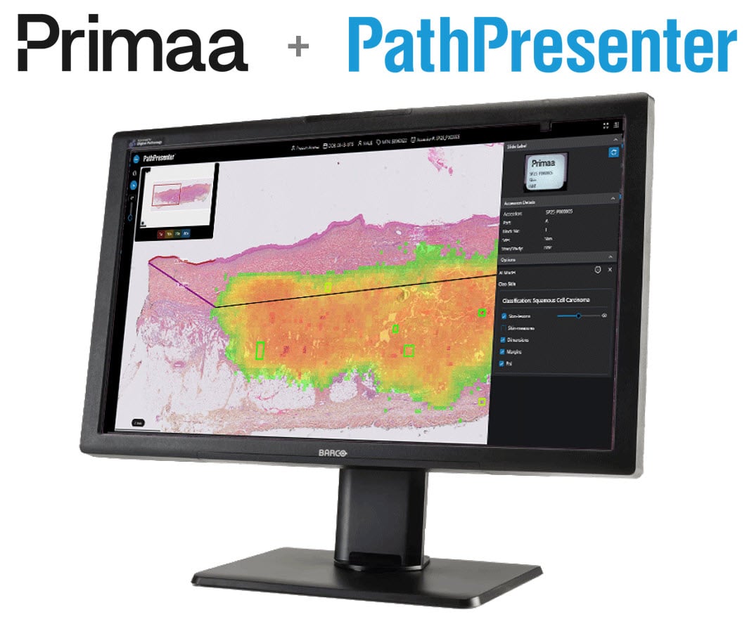 Primaa PathP Barco monitor 1 Primaa PathP Barco monitor 1